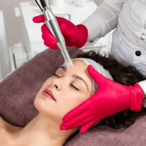 Microneedling